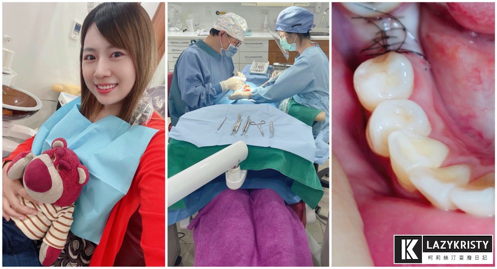 【音波電動牙刷推薦｜decopop靚白刷】用過就回不去！享受1分鐘震動4萬次微洗牙快感 充電1次續航力撐180天