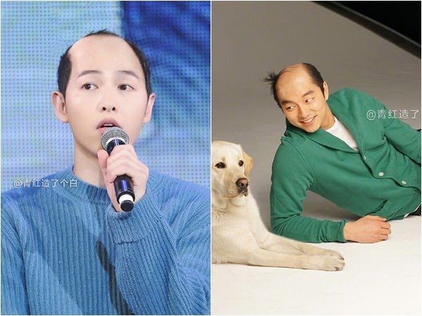 【禿頭落髮救星】不用植髮！無恢復期！3小時擁有茂密髮量～大推台北涵式紋繡的仿毛囊琇密術