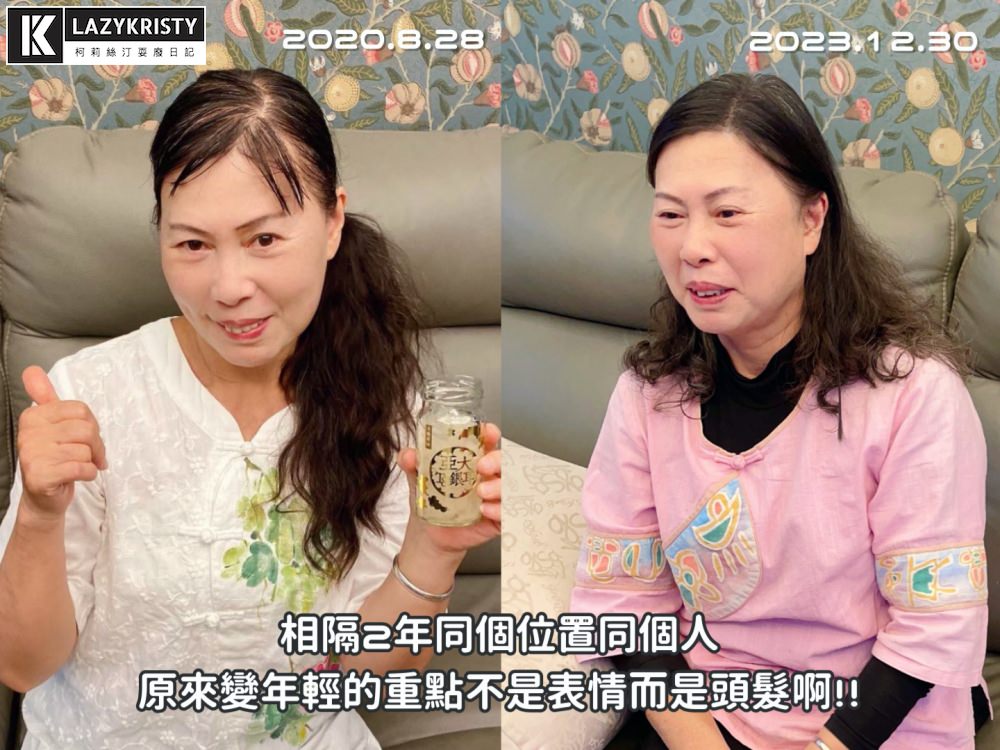 【禿頭落髮救星】不用植髮！無恢復期！3小時擁有茂密髮量～大推台北涵式紋繡的仿毛囊琇密術