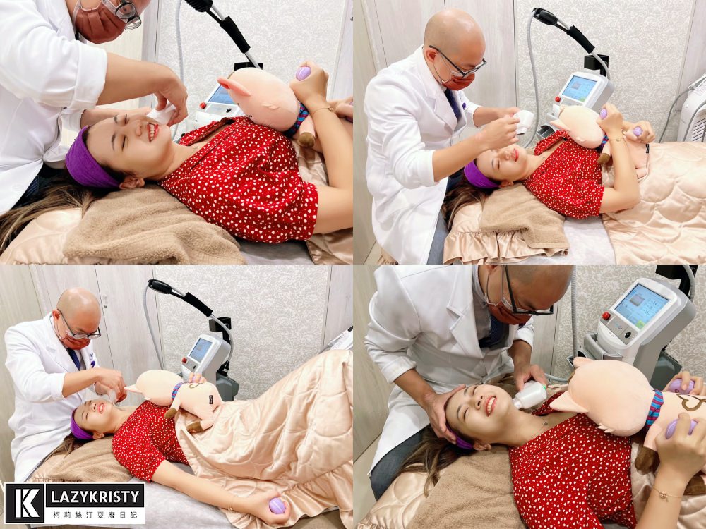 【滾開啦猖狂雙下巴】一招讓你找回消失的輪廓線！Q+立線音波拉提術後1個月多圖全紀錄