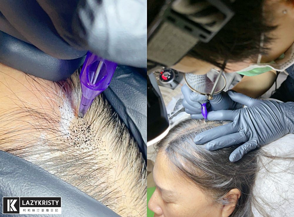 【禿頭落髮救星】不用植髮！無恢復期！3小時擁有茂密髮量～大推台北涵式紋繡的仿毛囊琇密術