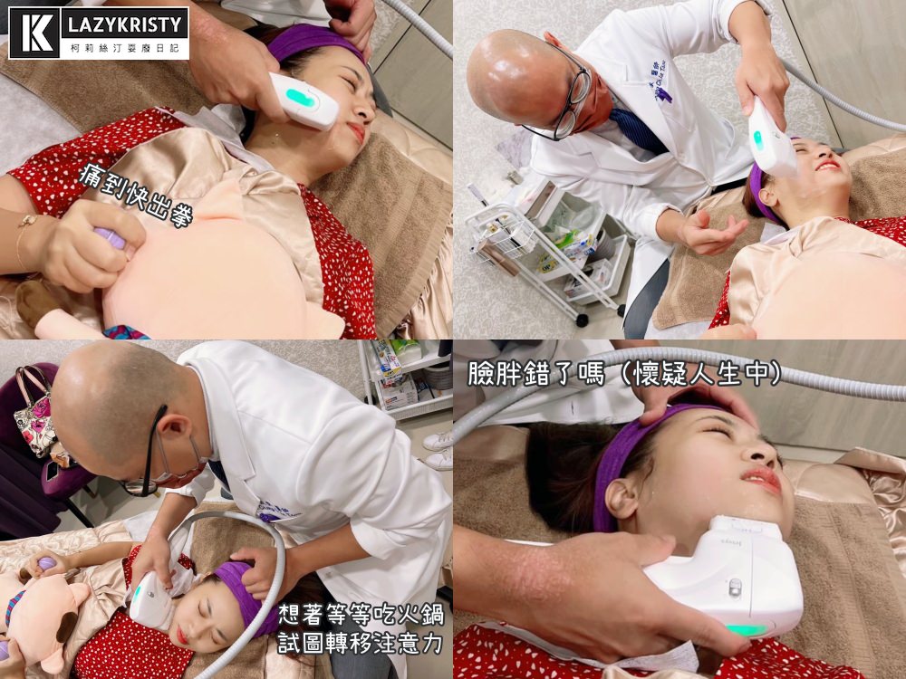 【滾開啦猖狂雙下巴】一招讓你找回消失的輪廓線！Q+立線音波拉提術後1個月多圖全紀錄