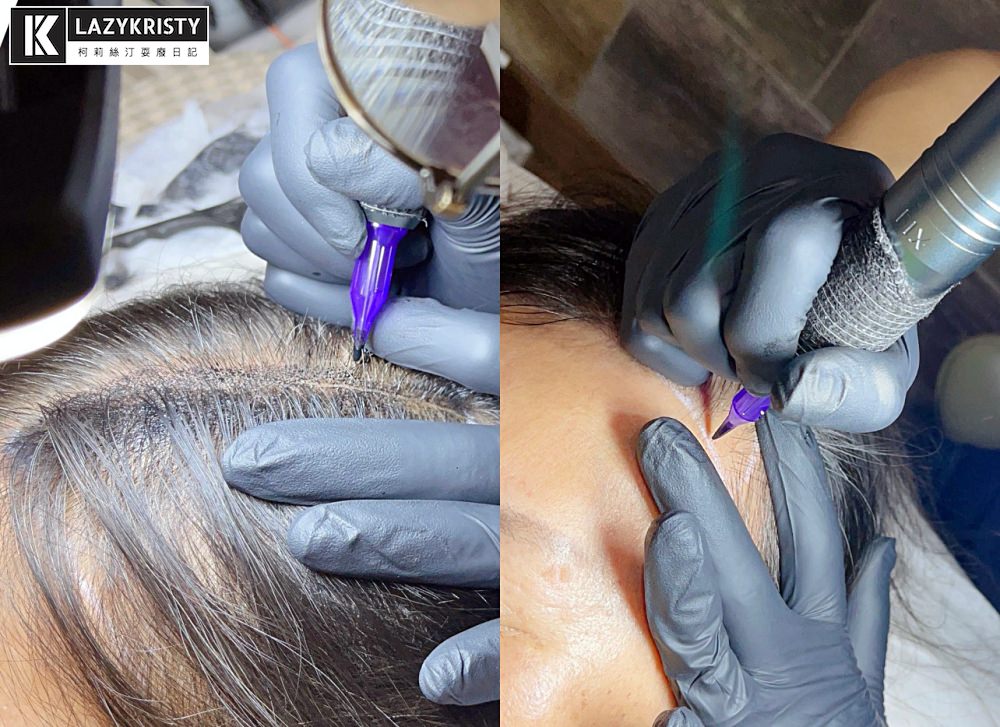 【禿頭落髮救星】不用植髮！無恢復期！3小時擁有茂密髮量～大推台北涵式紋繡的仿毛囊琇密術