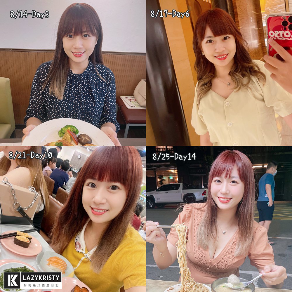 【滾開啦猖狂雙下巴】一招讓你找回消失的輪廓線！Q+立線音波拉提術後1個月多圖全紀錄