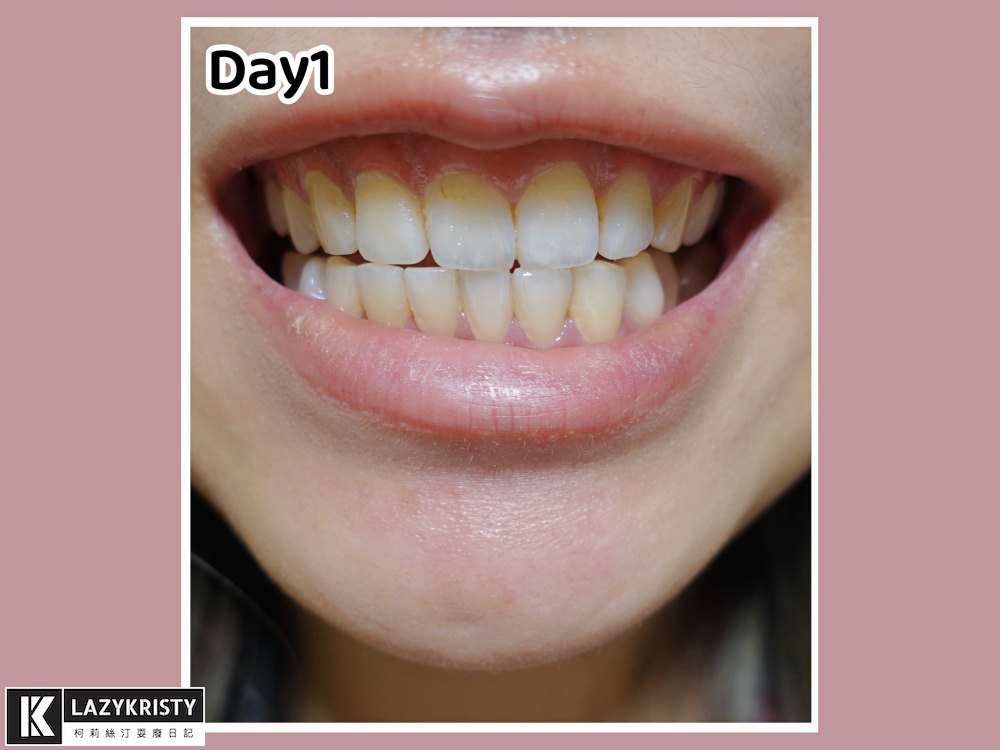 【音波電動牙刷推薦｜decopop靚白刷】用過就回不去！享受1分鐘震動4萬次微洗牙快感 充電1次續航力撐180天