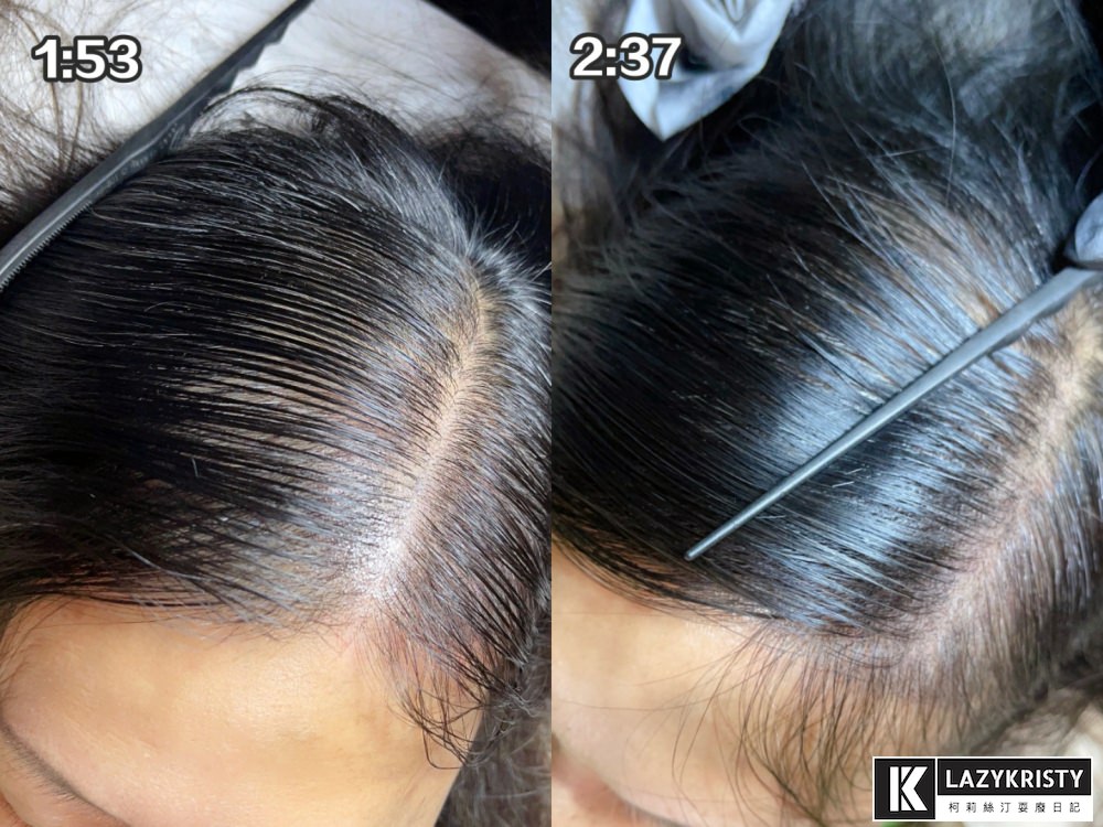 【禿頭落髮救星】不用植髮！無恢復期！3小時擁有茂密髮量～大推台北涵式紋繡的仿毛囊琇密術