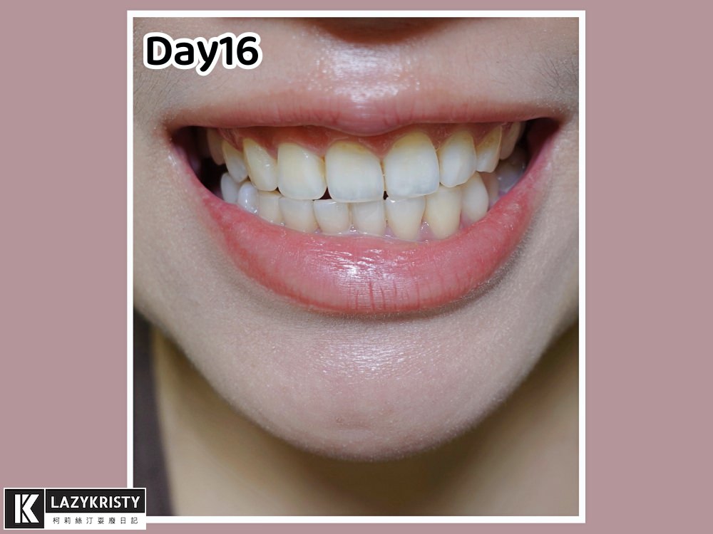 【音波電動牙刷推薦｜decopop靚白刷】用過就回不去！享受1分鐘震動4萬次微洗牙快感 充電1次續航力撐180天