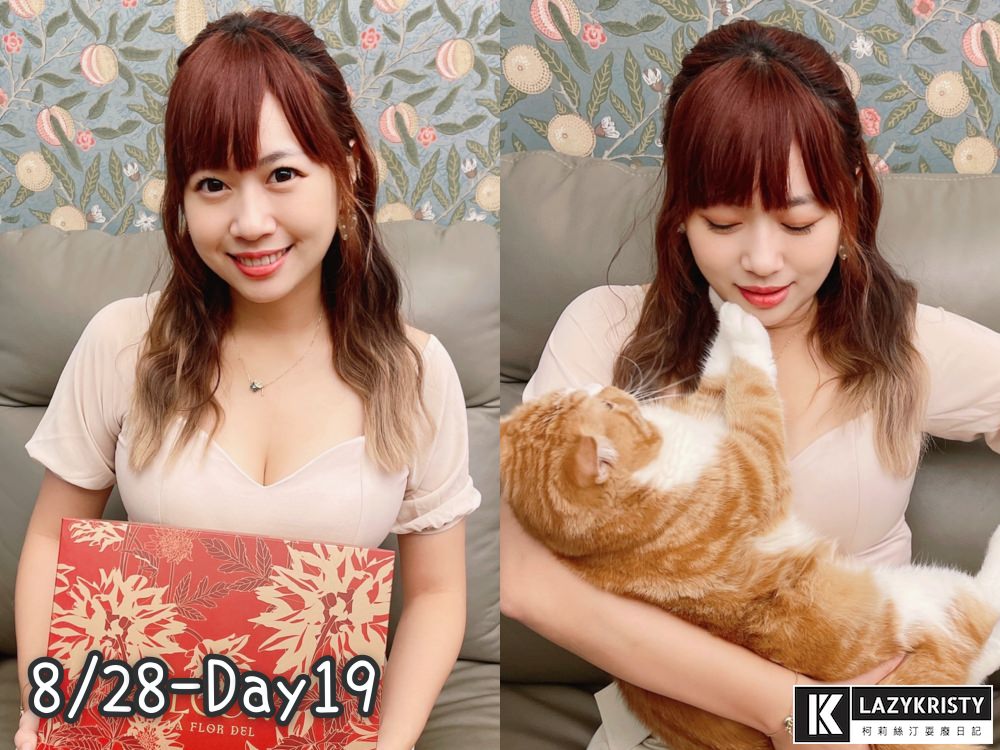 【滾開啦猖狂雙下巴】一招讓你找回消失的輪廓線！Q+立線音波拉提術後1個月多圖全紀錄