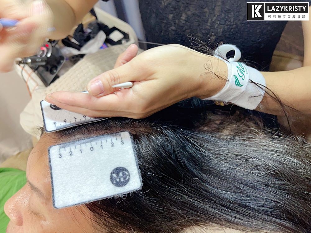 【禿頭落髮救星】不用植髮！無恢復期！3小時擁有茂密髮量～大推台北涵式紋繡的仿毛囊琇密術
