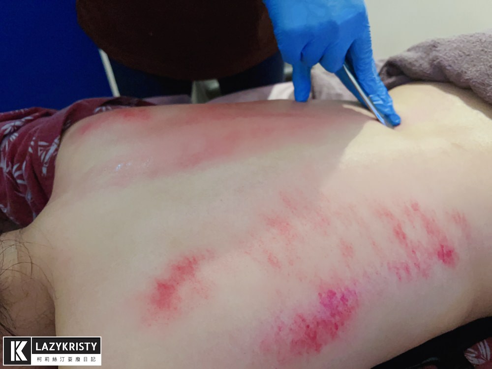 【INDIBA+筋膜刀運動按摩推薦】嘉義第一台肌肉保養神器！躺著就能跟緊繃說掰掰還能修修臉？ （嘉義足步足體養生館）