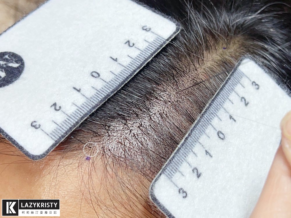 【禿頭落髮救星】不用植髮！無恢復期！3小時擁有茂密髮量～大推台北涵式紋繡的仿毛囊琇密術