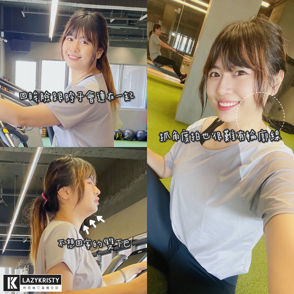 【滾開啦猖狂雙下巴】一招讓你找回消失的輪廓線！Q+立線音波拉提術後1個月多圖全紀錄