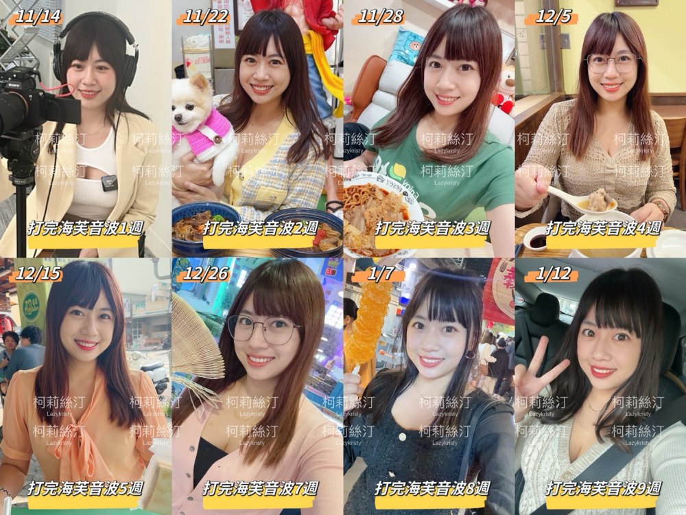 【輪廓線回來啦】第三代海芙音波超有感!拉提緊實一次搞定~台中豐原日曦美學診所推薦 - 第23張圖 【輪廓線回來啦】第三代海芙音波超有感!拉提緊實一次搞定~台中豐原日曦美學診所推薦