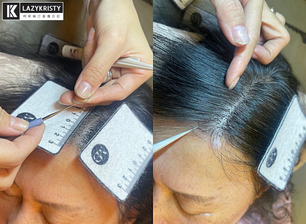 【禿頭落髮救星】不用植髮！無恢復期！3小時擁有茂密髮量～大推台北涵式紋繡的仿毛囊琇密術