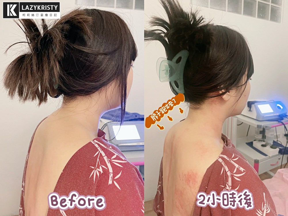 【INDIBA+筋膜刀運動按摩推薦】嘉義第一台肌肉保養神器！躺著就能跟緊繃說掰掰還能修修臉？ （嘉義足步足體養生館）