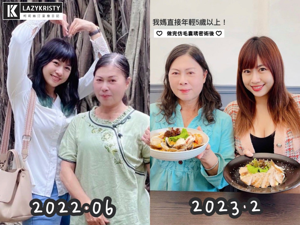 【禿頭落髮救星】不用植髮！無恢復期！3小時擁有茂密髮量～大推台北涵式紋繡的仿毛囊琇密術