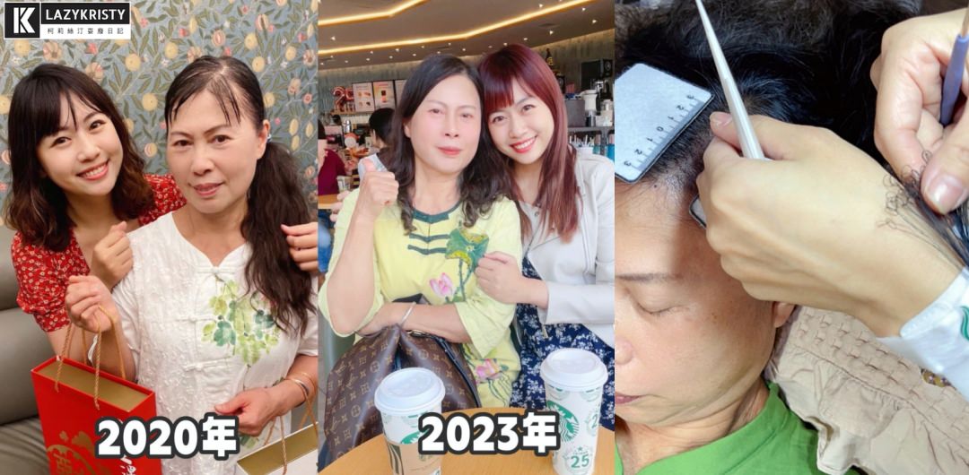 【禿頭落髮救星】不用植髮！無恢復期！3小時擁有茂密髮量～大推台北涵式紋繡的仿毛囊琇密術