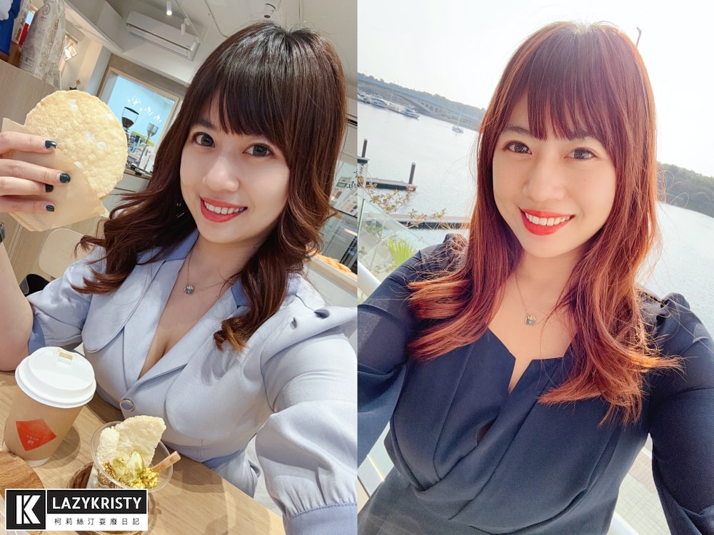 【不動刀消滅雙下巴醫美首選】打消脂針會痛嗎?消脂針會腫多久?(多圖完整紀錄)|台南美美上美診所 - 第25張圖 【不動刀消滅雙下巴醫美首選】打消脂針會痛嗎?消脂針會腫多久?(多圖完整紀錄)|台南美美上美診所